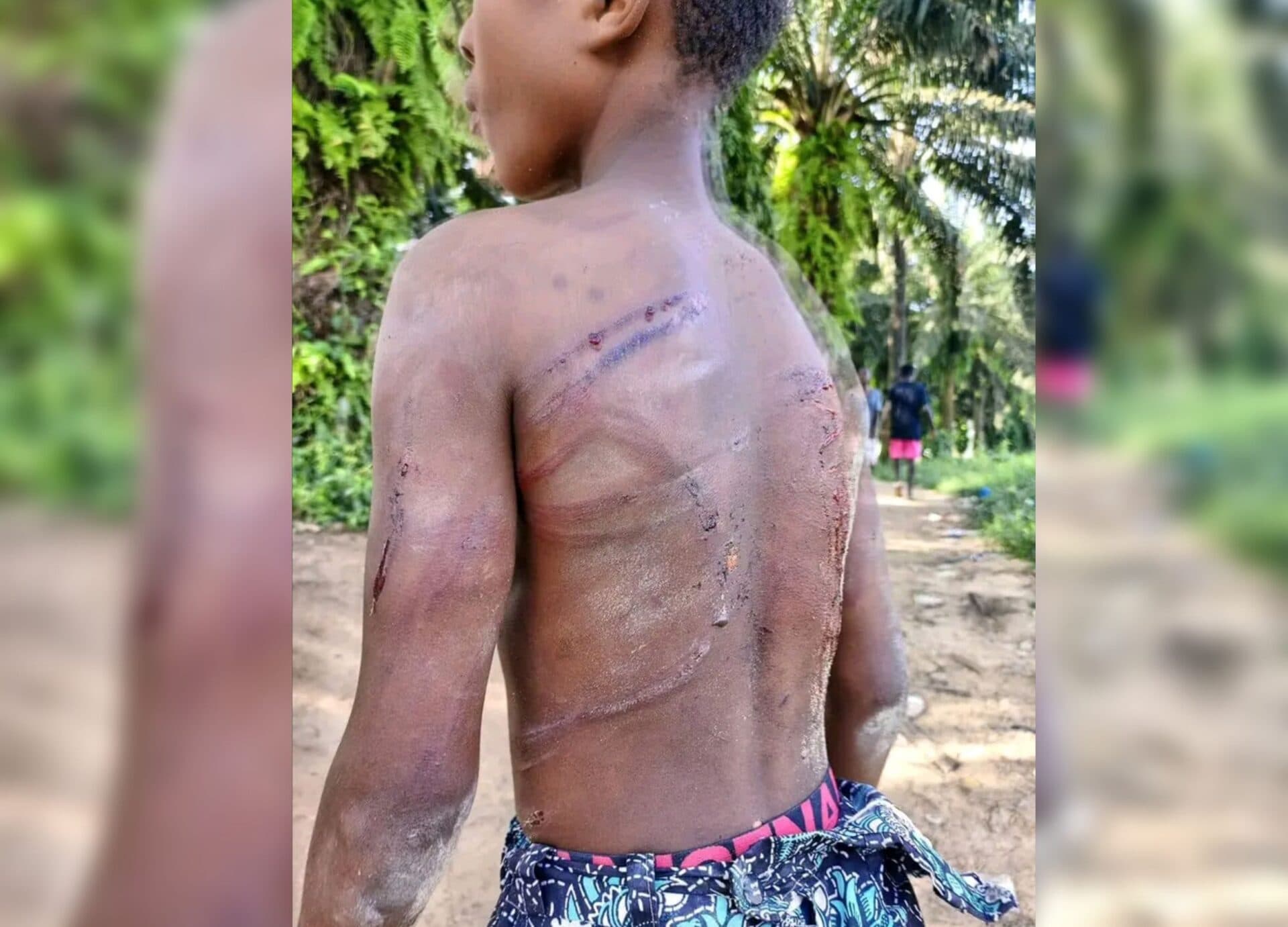 Côte d'Ivoire : La ministre Nassénéba Touré s'insurge contre la maltraitance d'un enfant à Montezo