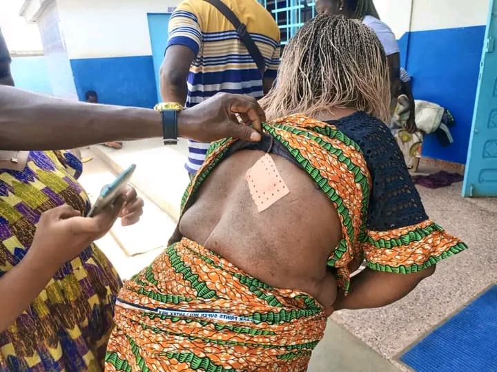 Côte d’Ivoire : Vavoua, une enseignante attaquée par un bœuf