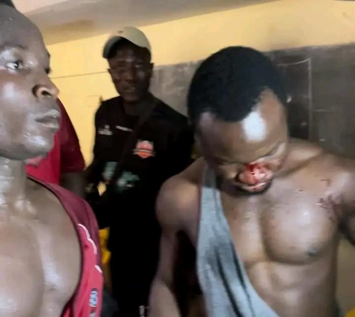 Guinée : Des joueurs de Renaissance Fc attaqués et tabassés à sang par des supporters de l'équipe adverse