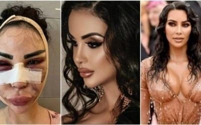 Dubaï : Elle dépense 600 000 dollars pour ressembler à Kim Kardashian et débourse 120 000 dollars pour redevenir elle-même