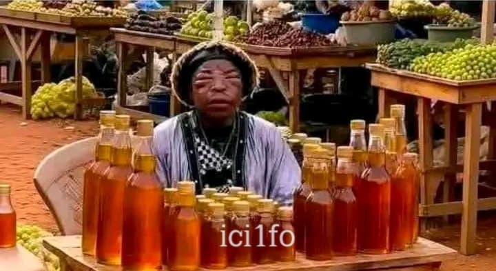 Kenya : Il se laisse piquer par des abeilles pour prouver que son miel est 100% naturel 